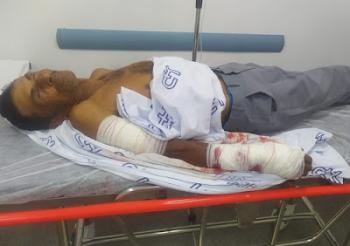 Idoso leva mais de 20 pontos no braço após ser atacado por cão da raça pitbull